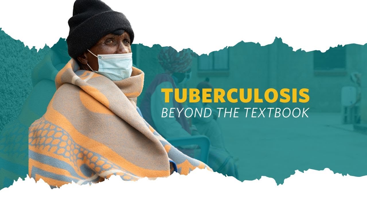 Tuberculosis Beyond the Textbook: Gaps, Innovation, and Health Systems Realities