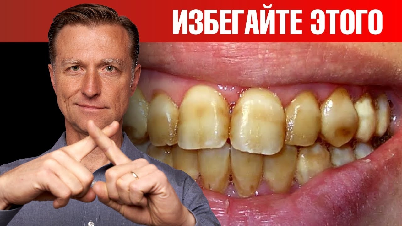 Худшая пища для зубов. И это НЕ САХАР! 😲