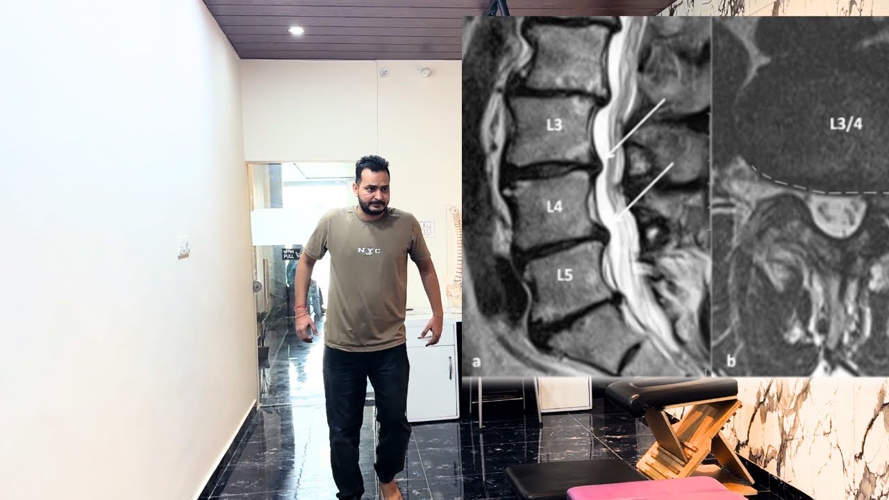 L3-L4, L4-L5, L5-S1 Disc Bulge Relief | Chiropractic Adjustment for Lower Back Pain