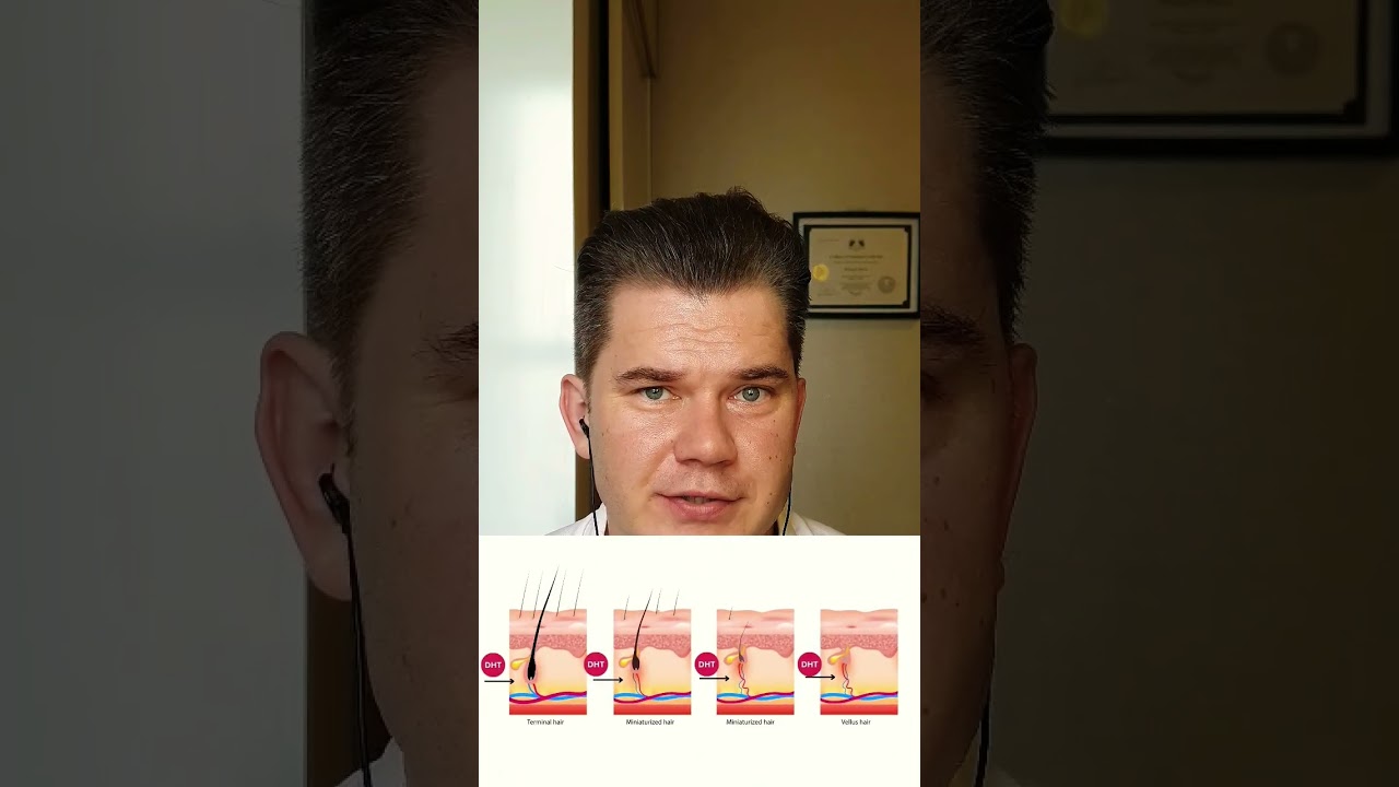 How To Find Out If Hair Loss Is Caused by Microinflammation?
