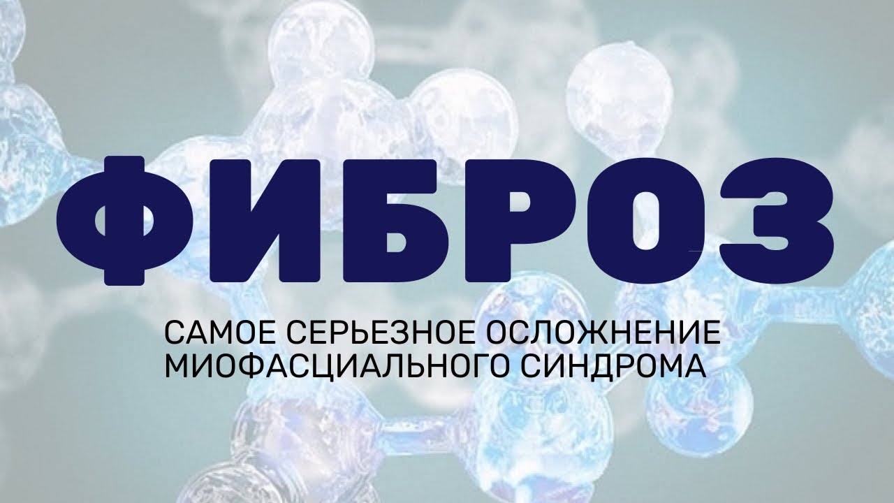 Фиброз мышц. Исследования Миофасциального синдрома. Как возникают триггерные точки и фиброз