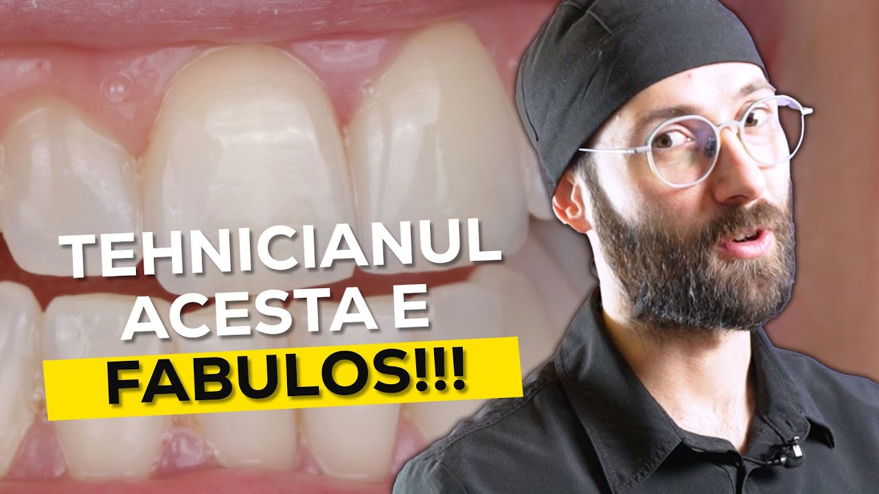 Fatete mai naturale NU EXISTA