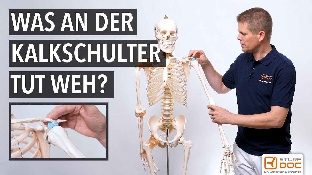 Was an der Kalkschulter tut weh?