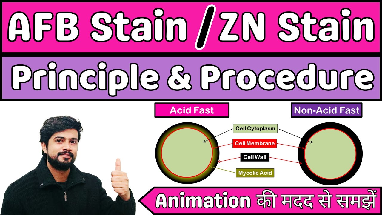 🔴AFB Stain🟣|| ZN stain || Tb Stain || Principle & Procedure || Microbiology in Hindi