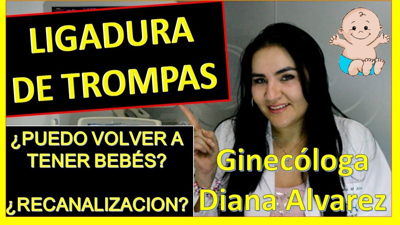 LIGADURA DE TROMPAS,  ¿PUEDO VOLVER A EMBARAZARME?, POR GINECOLOGA DIANA ALVAREZ