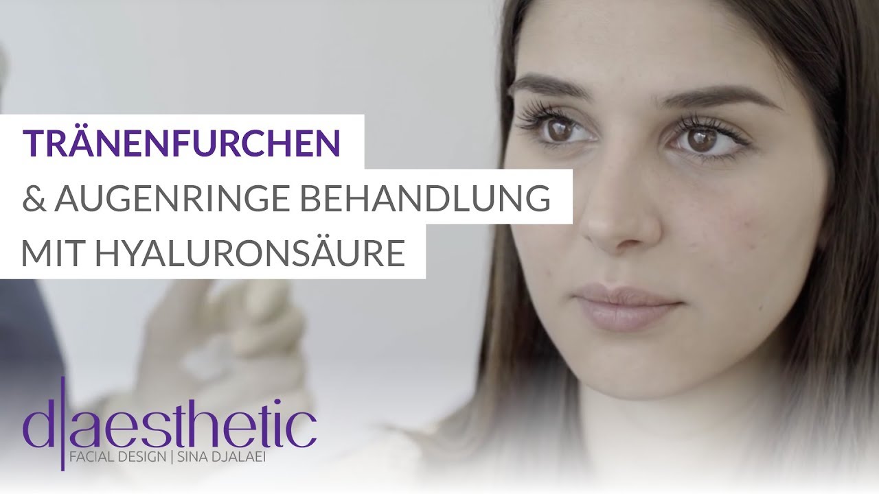 Tränenfurchen und Augenringe unterspritzen | Behandlung mit Hyaluronsäure | d-aesthetic