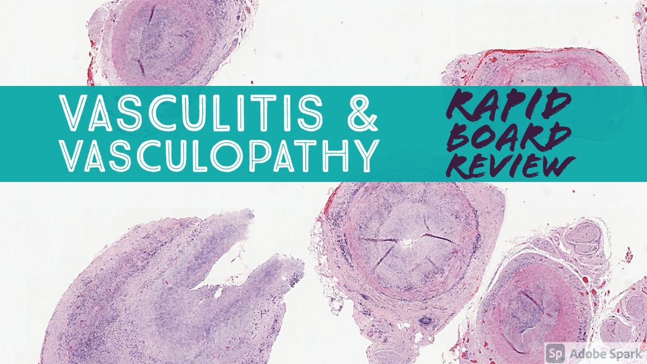 Dermpath Board Review: Vasculitis & Vasculopathy (Dermpath Dermatology Pathology)