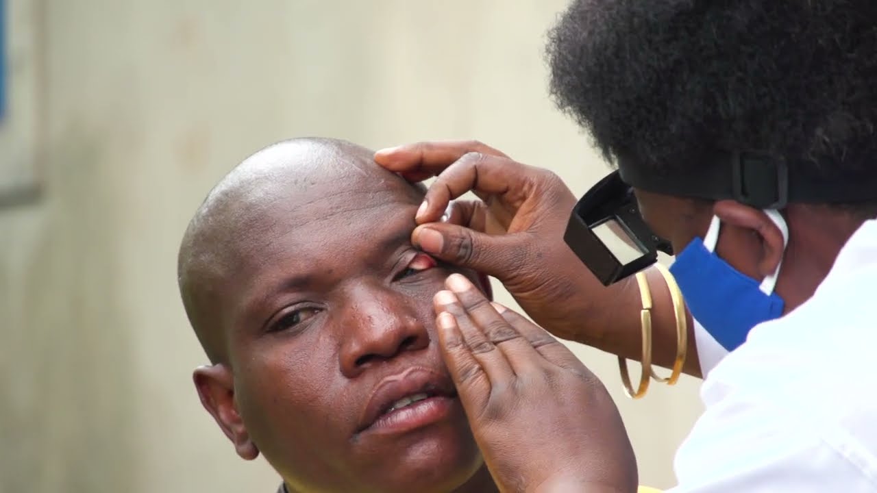 How Burundi defeated trachoma through collective action