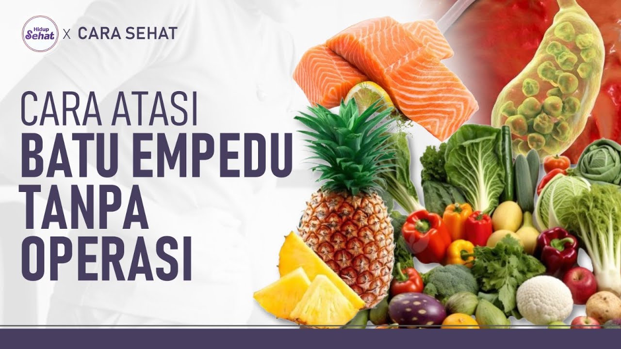 Tanpa Operasi! Ini Tips Mengatasi Batu Empedu Secara Alami | Hidup Sehat tvOne