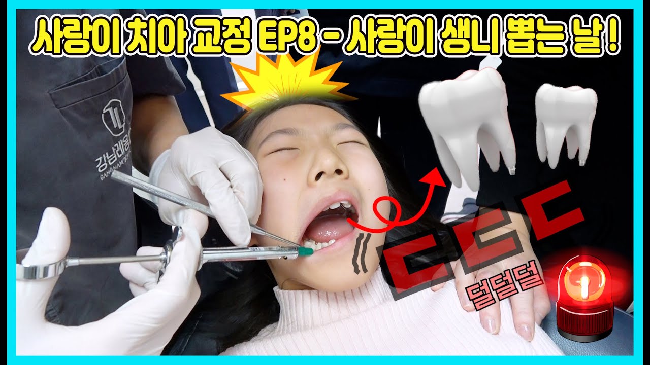 [치아교정EP8] 치아교정을 위해 생니를 뽑고 아래쪽에 치아교정용철사를 달았어요! 생니뽑는거 너무 무서워요ㅠㅠ EP8 [사랑아놀자 LOVE&TORY]
