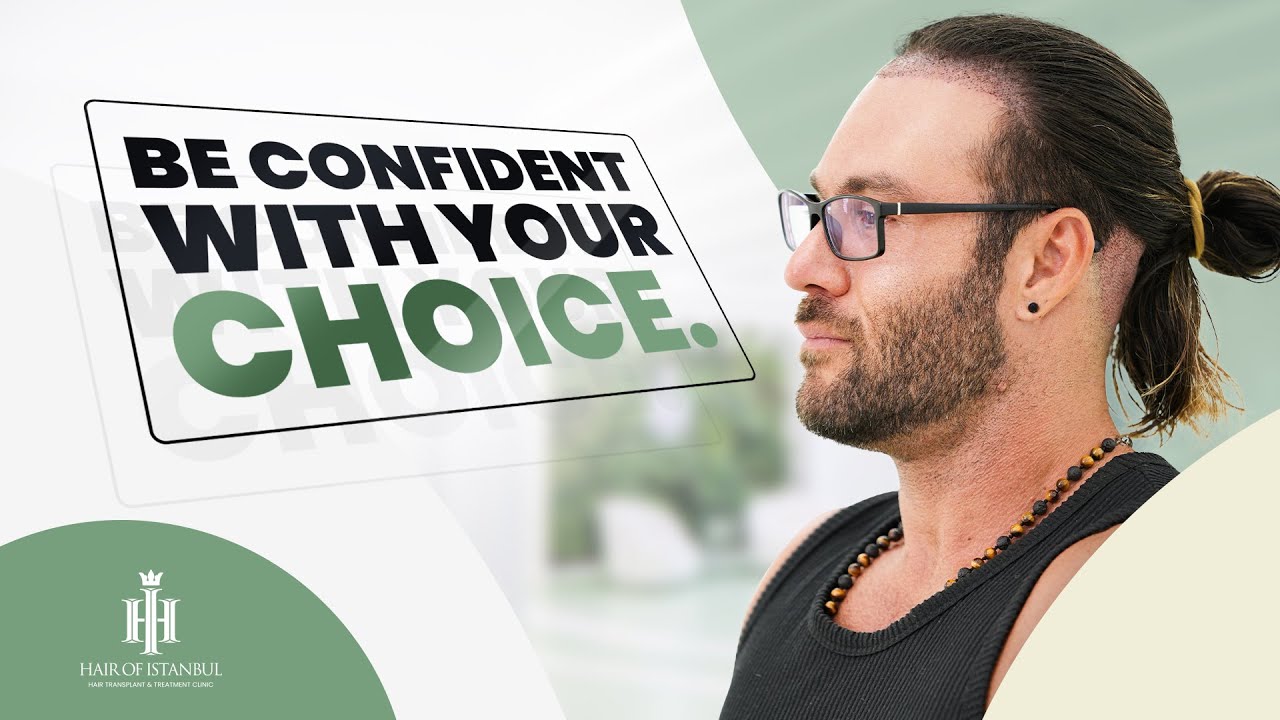 New Hair, New Confidence: Derek’s Story at Hair of Istanbul