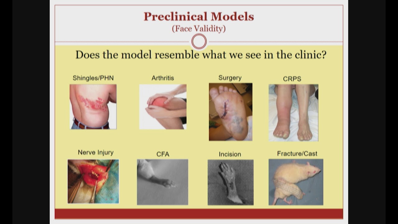 Animal Models and Translational Pain Research