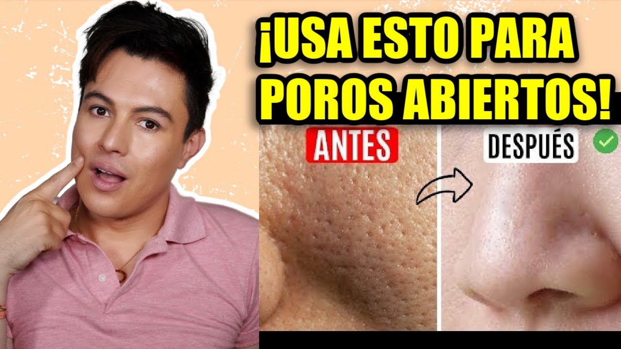 Cosas Que Si Sirven Para Los Poros Abiertos | Yasmany