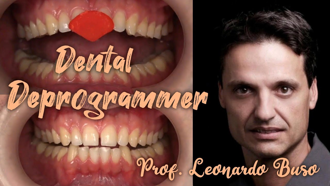 Determination of central occlusion centric relation . Deppogrammer.  Prof. Leonardo Buso