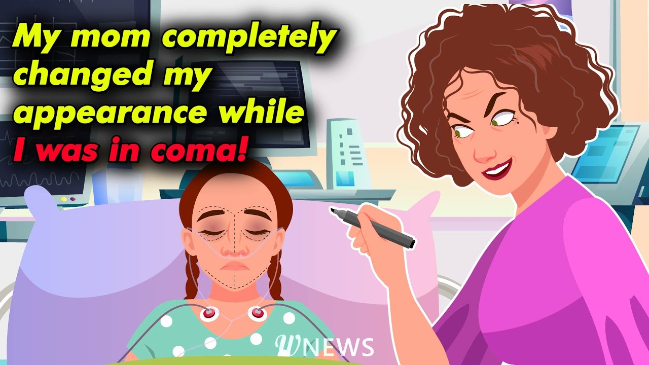 While I was in coma, my mom completely changed my face!