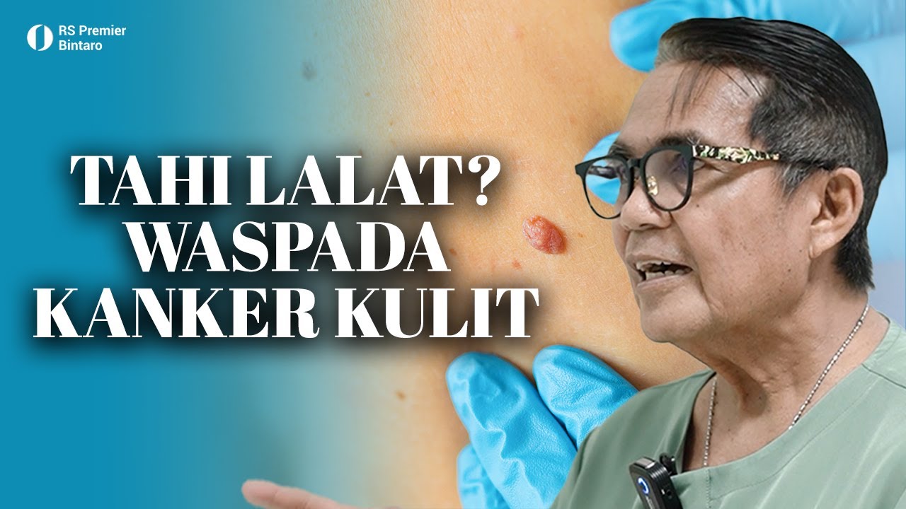 Luka Tak Kunjung Sembuh, Tahi Lalat Semakin Membesar? Waspada Kanker Kulit!