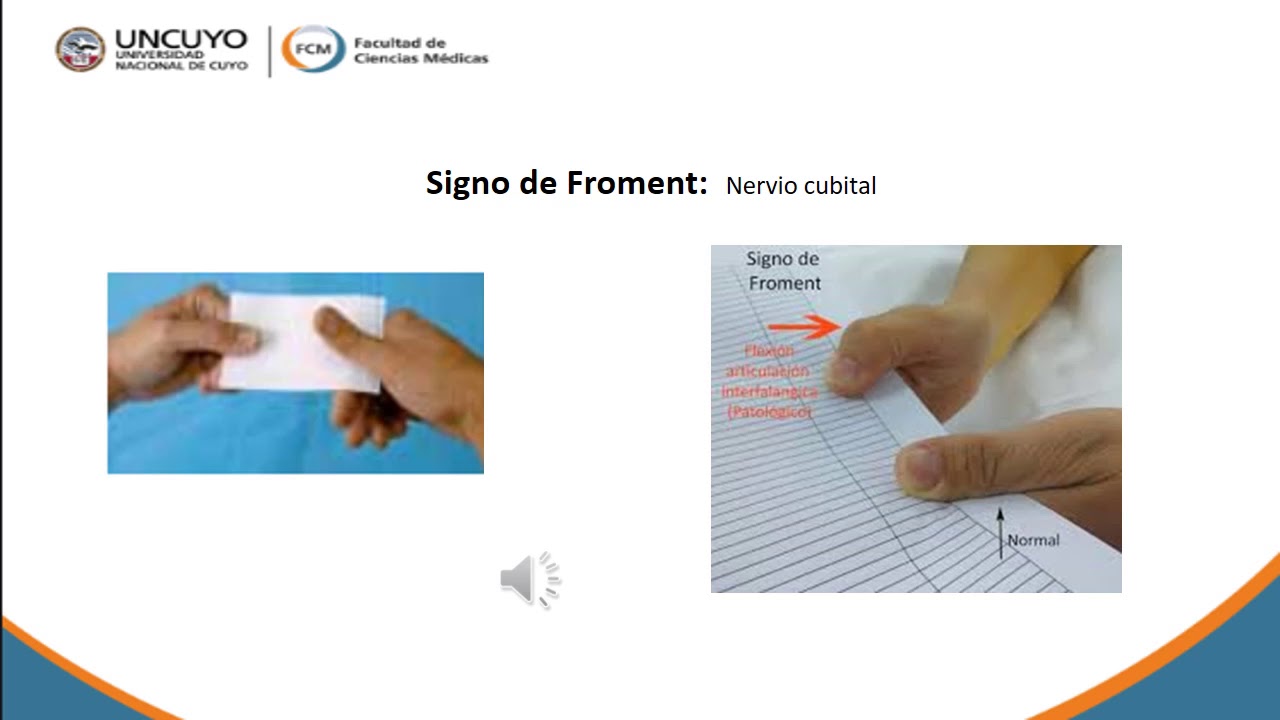 SEMIOLOGÍA DE LA MUÑECA Y LA MANO