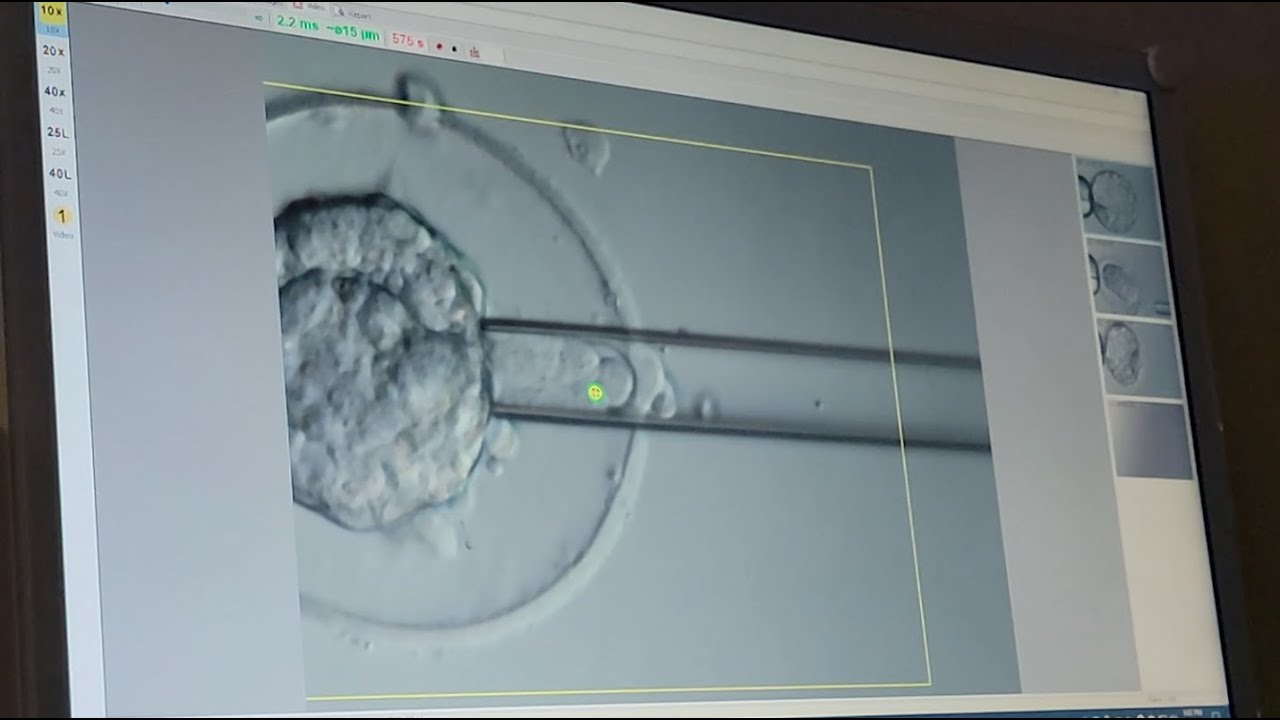 What Happens During an Embryo Biopsy?