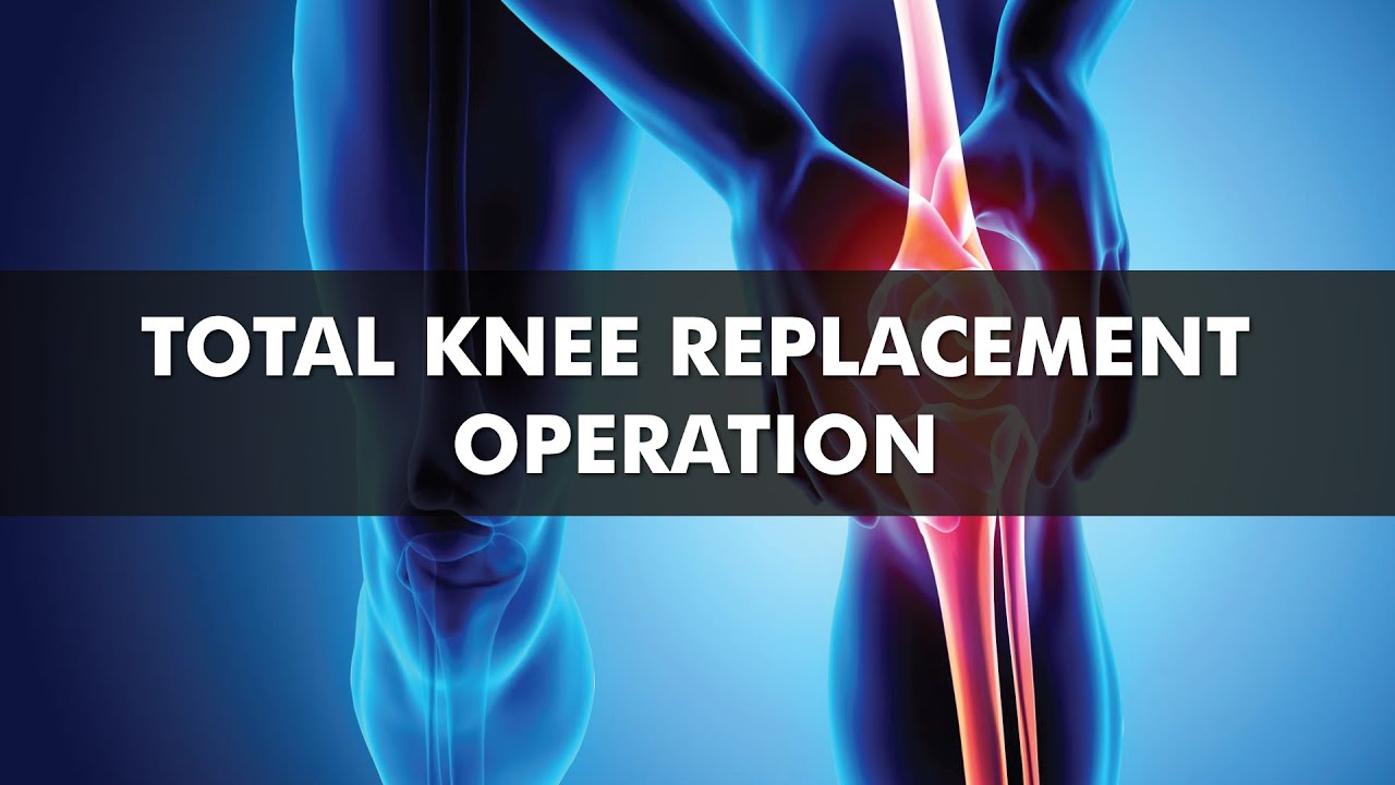 Patient Journey - Shoaib M  | Total Knee Replacement Operation | Dr. Amit Vaid
