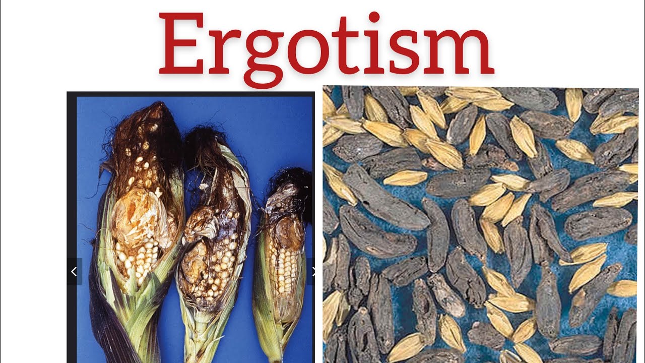 Ergotism and fescue toxicity