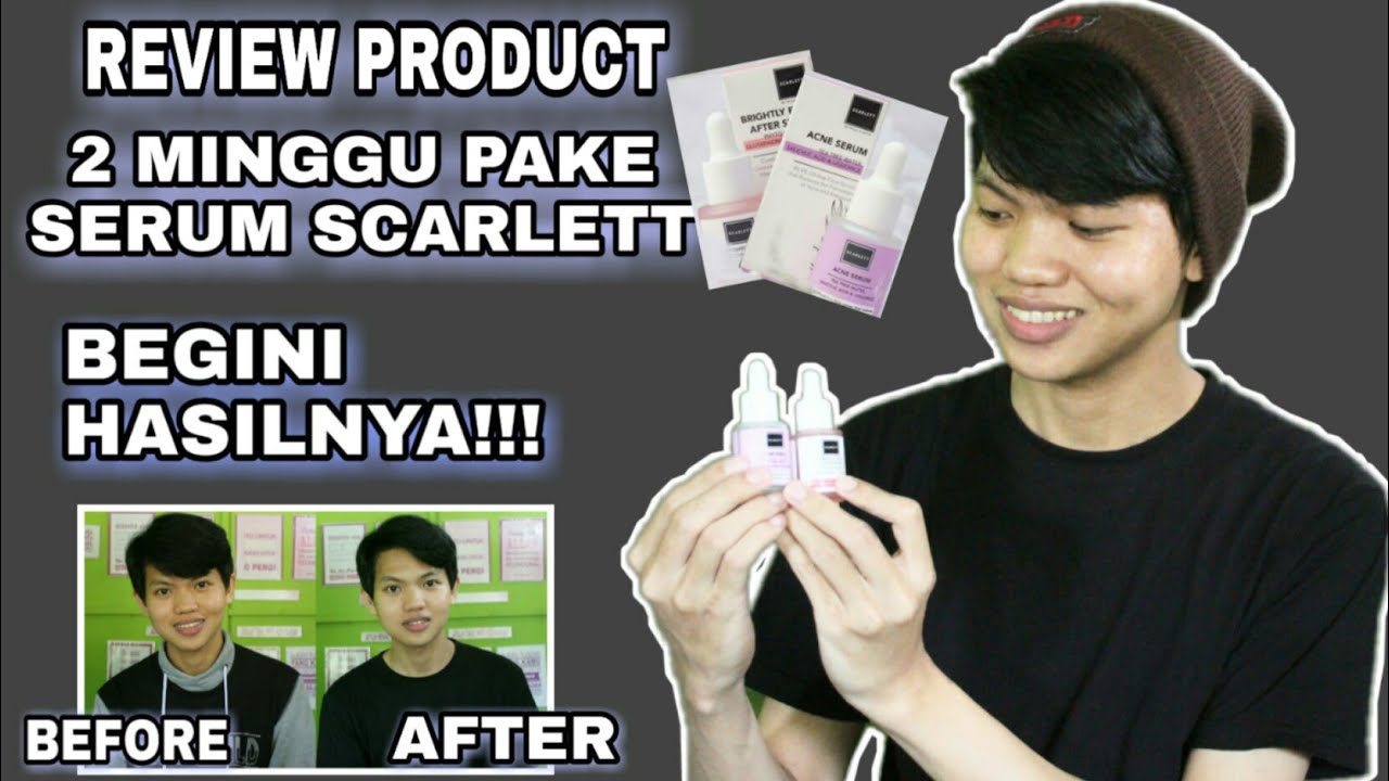 REVIEW SERUM SCARLETT WHITENING!!!