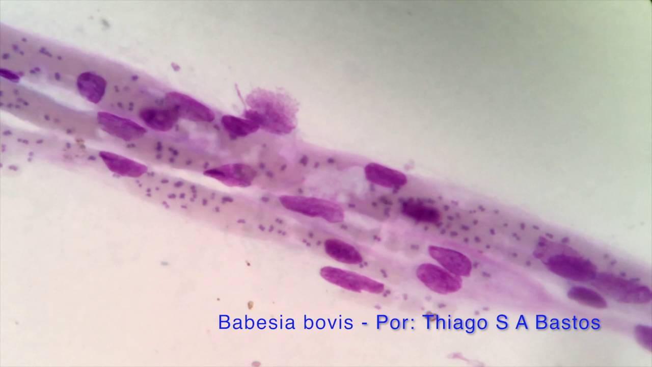 Babesia bovis
