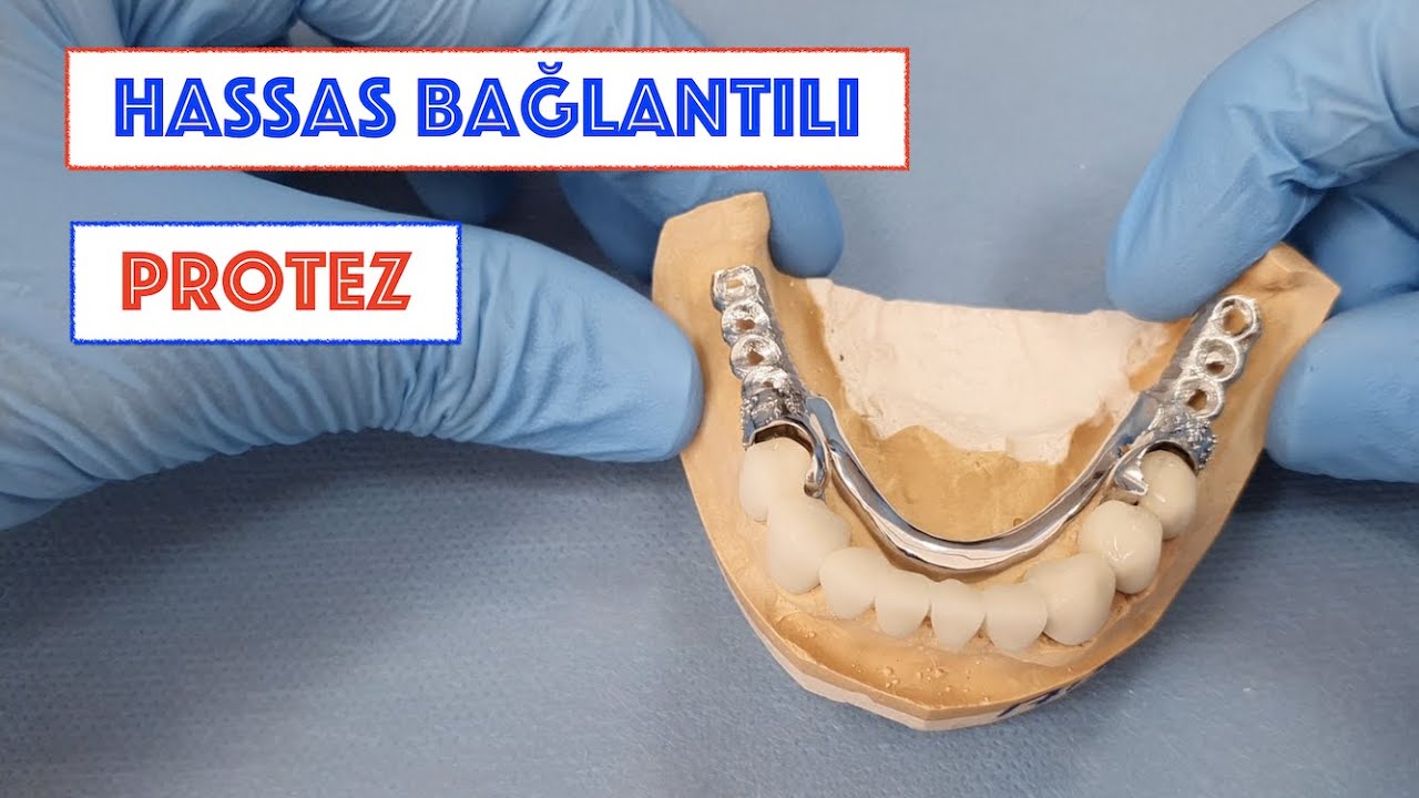Hassas Bağlantılı Protez