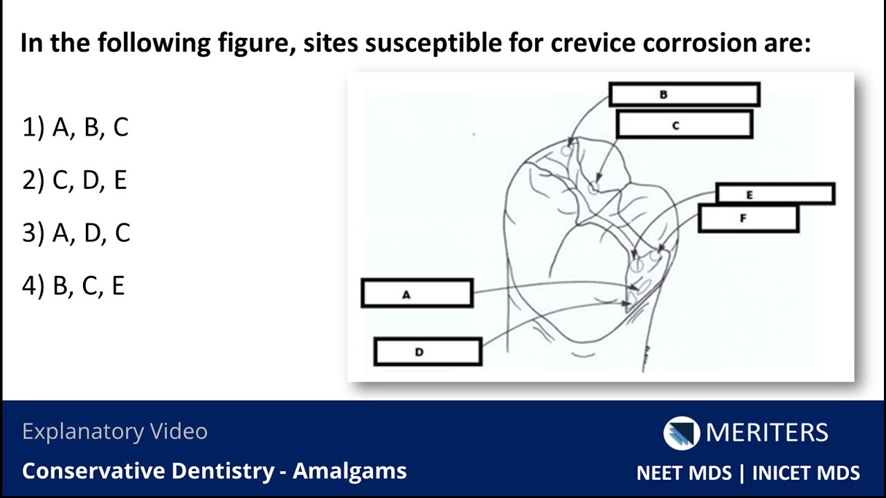 NEET MDS | INICET - Conservative Dentistry - Amalgams | Explanatory Video | MERITERS