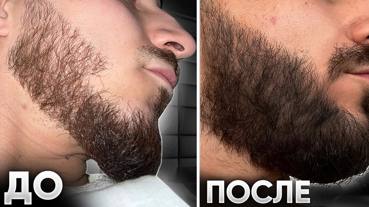 Увеличил густоту бороды и зарастил коннекторы / Результаты mr.Volos