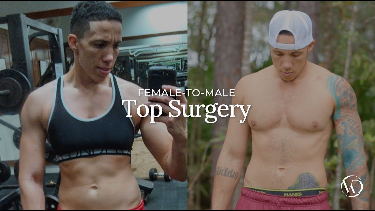 Female-To-Male Top Surgery | Morgan's Story