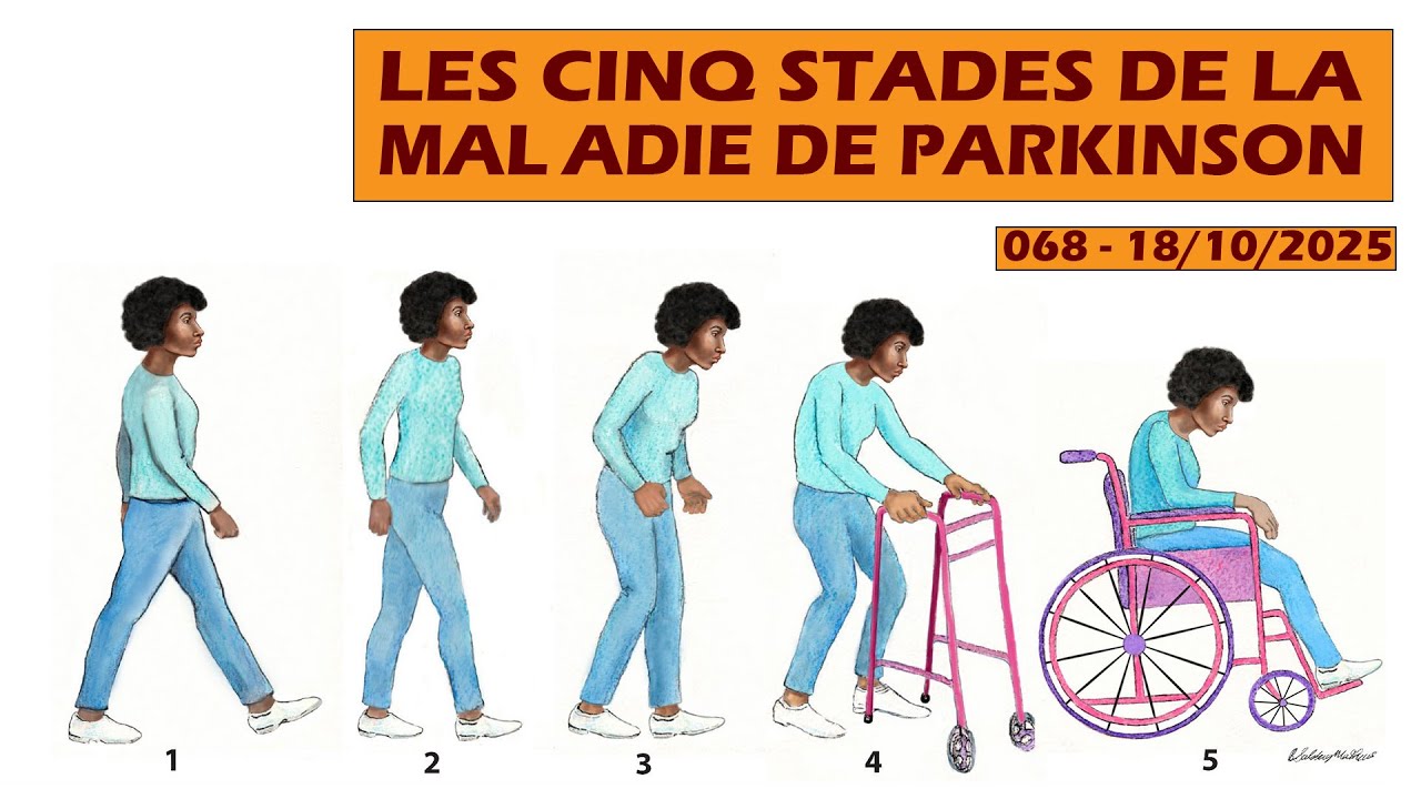 Parkinson's Follies 068 : les cinq stades de la maladie de Parkinson