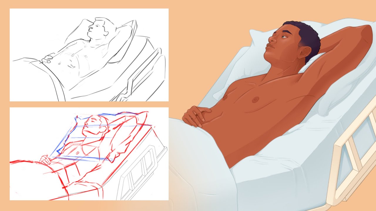 Medical illustration production tips: How to develop a rough figure sketch into an illustration