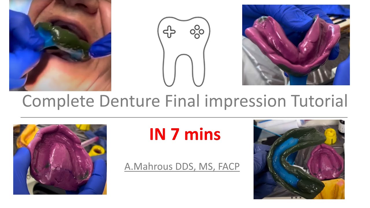 Complete denture final impression tutorial in 7 mins