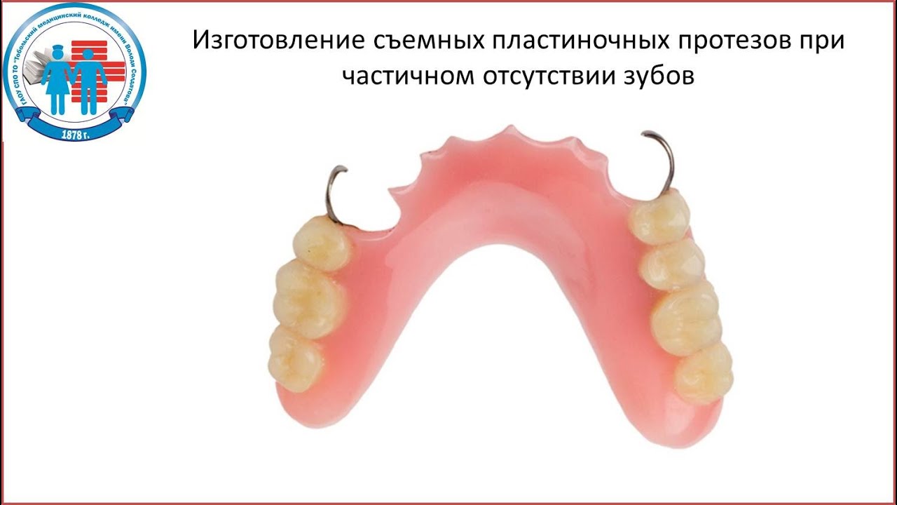 Изготовление съемных пластиночных протезов при час