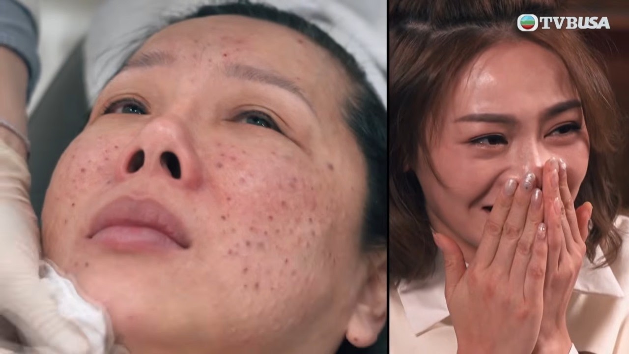 醫美直擊 首爾篇｜黑盒VS長效針被稱最痛醫美針？卓欣親身挑戰天花板級痛感｜何依婷｜韓國｜醫美
