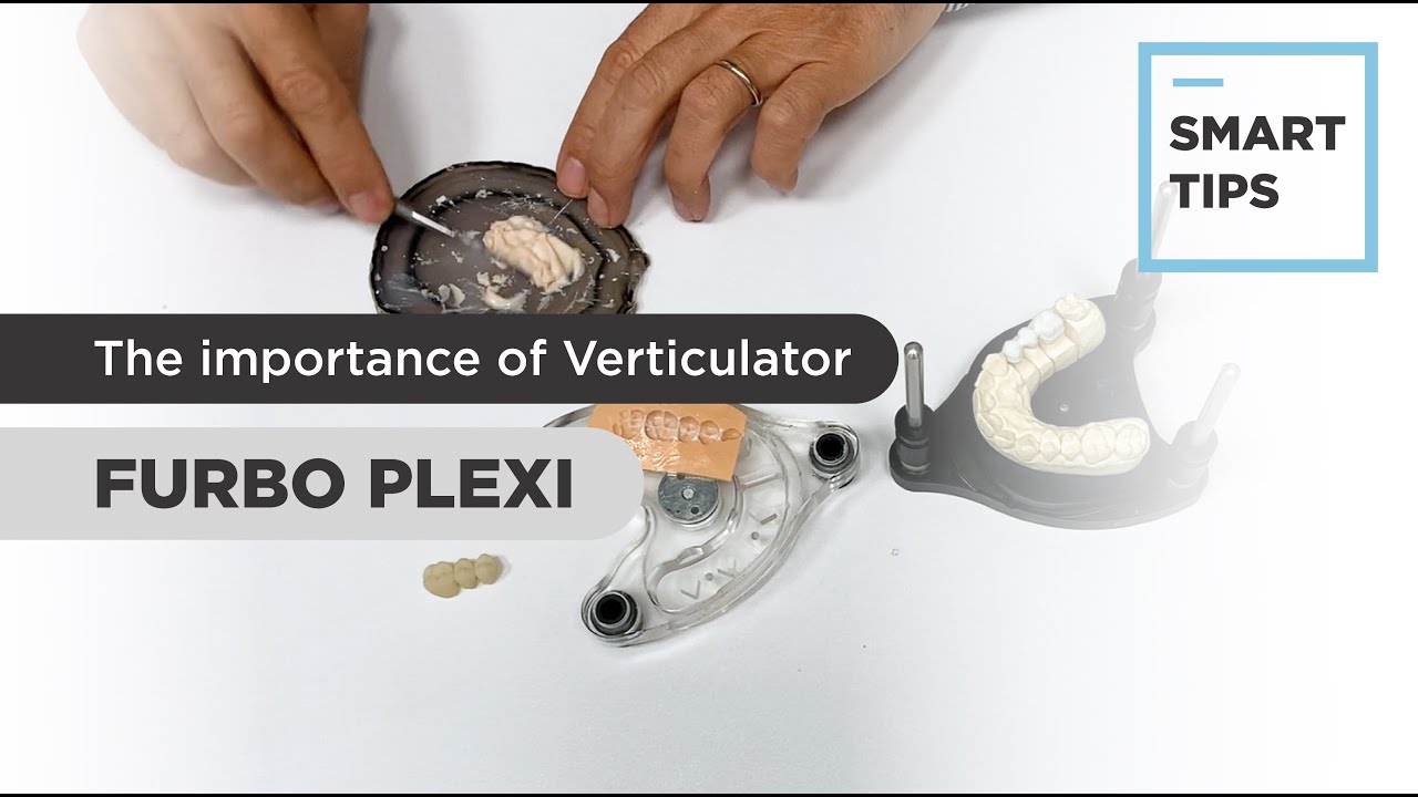 SMART TIPS | The thousand uses of Furbo Plexi 🇬🇧