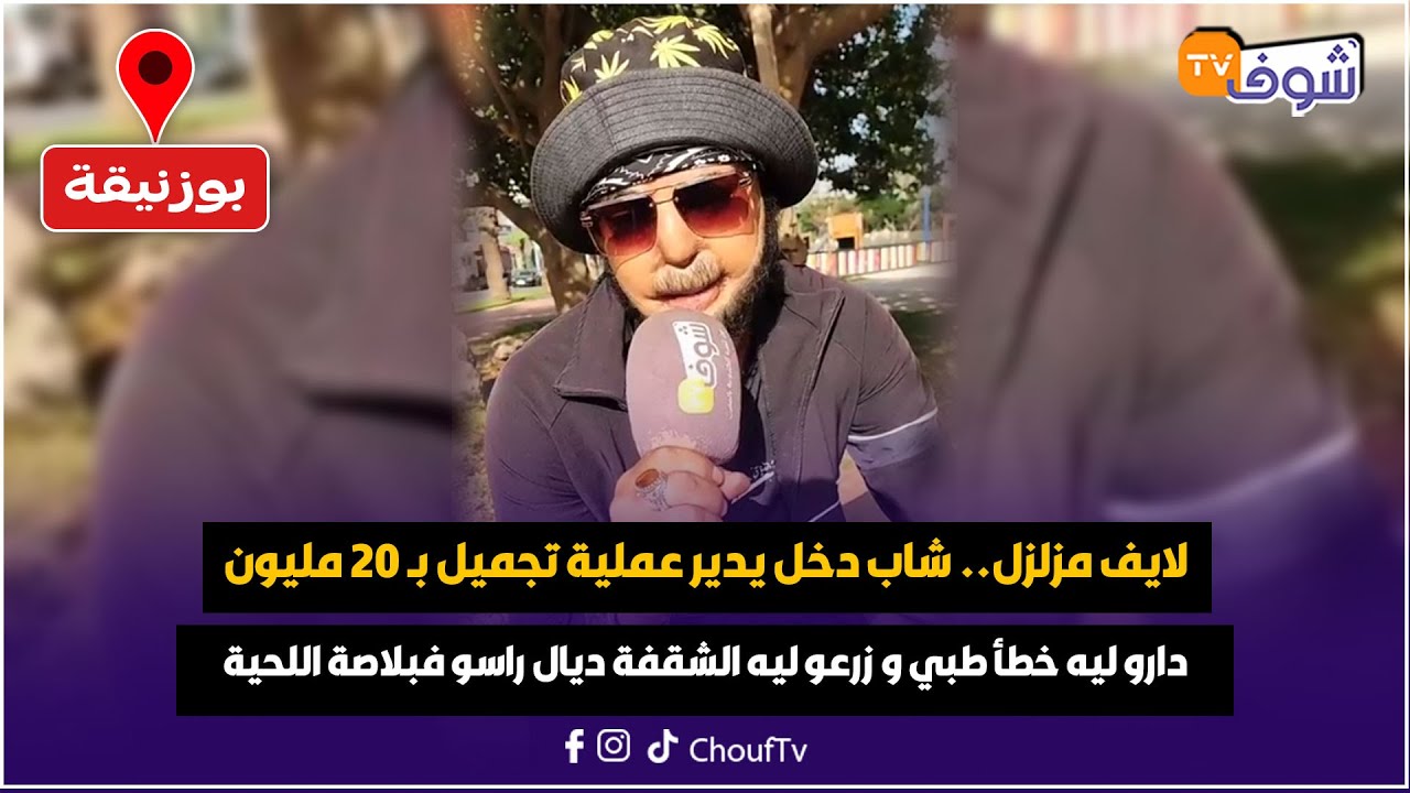 شاب دخل يدير عملية تجميل بـ 20 مليون دارو ليه خطأ طبي و زرعو ليه الشقفة ديال راسو فبلاصة اللحية