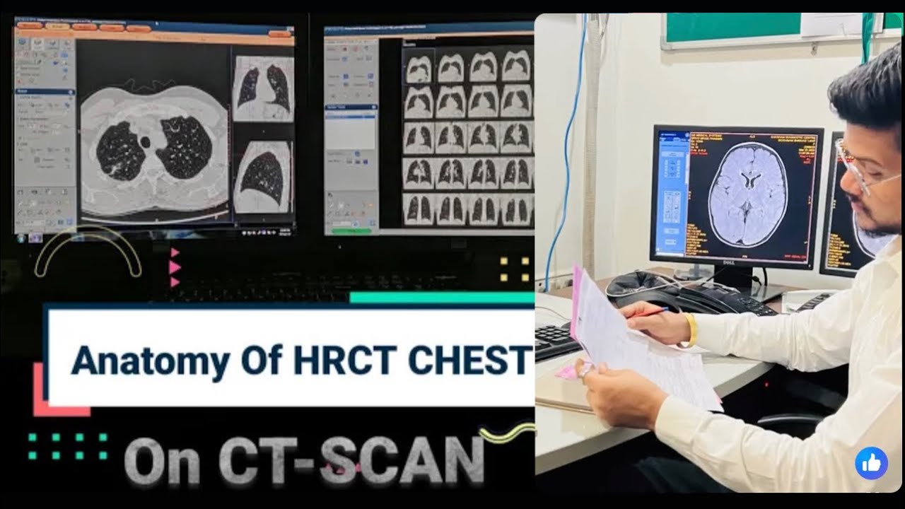 Anatomy of HRCT CHEST in Hindi | Pawan Kumar|