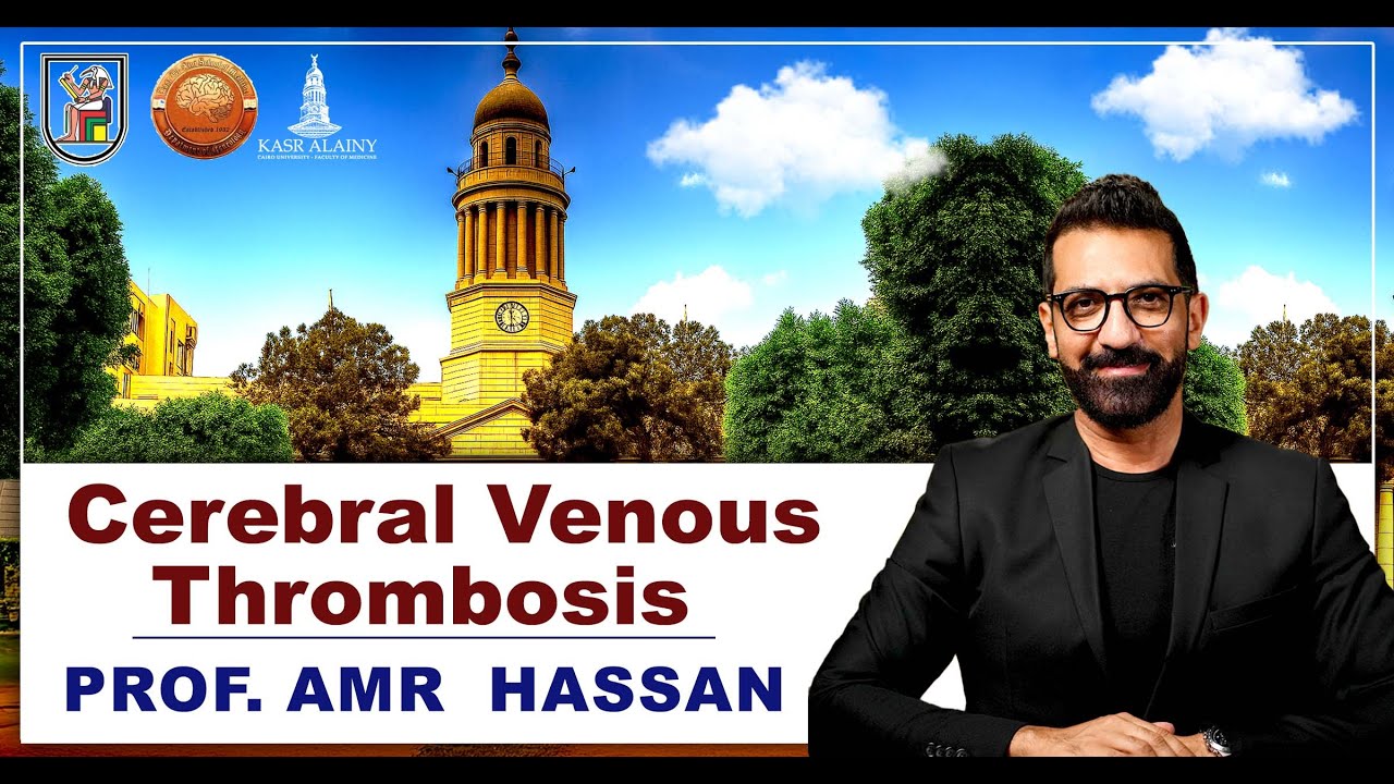 أ.د.عمرو حسن الحسني أستاذ المخ والأعصاب-Cerebral Venous Thrombosis