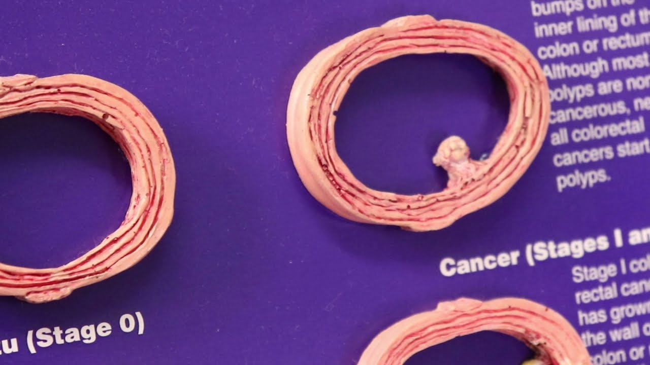 English- Colon Cancer & FIT Kit Step-by-step Instructions
