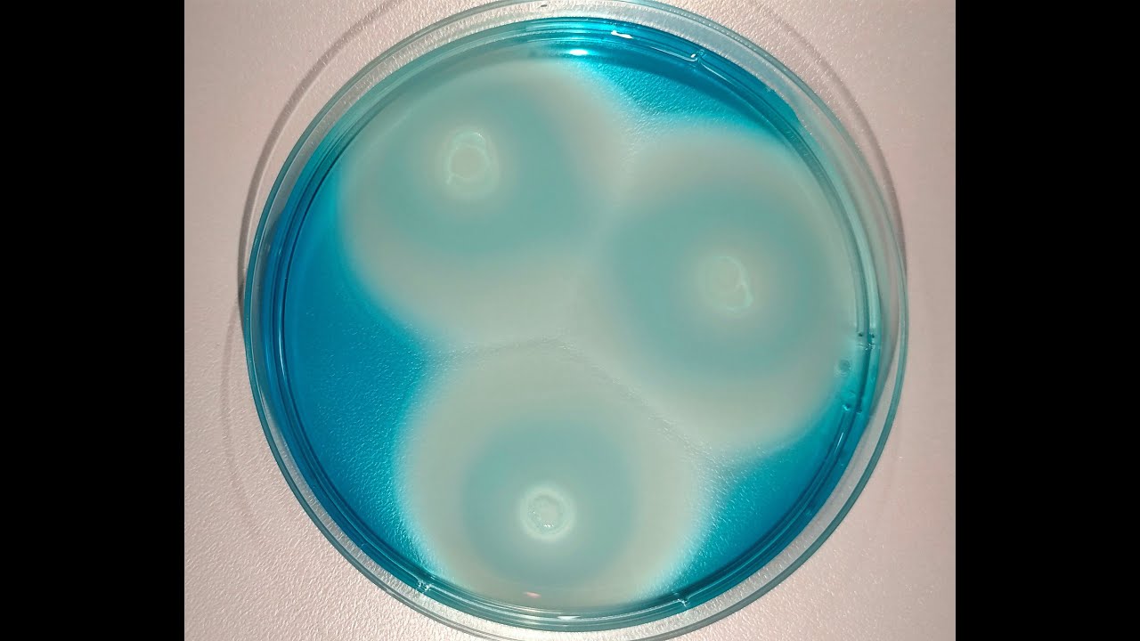 Identificazione della Salmonella in pollo e acqua (metodo MSRV) - Corso di microbiologia