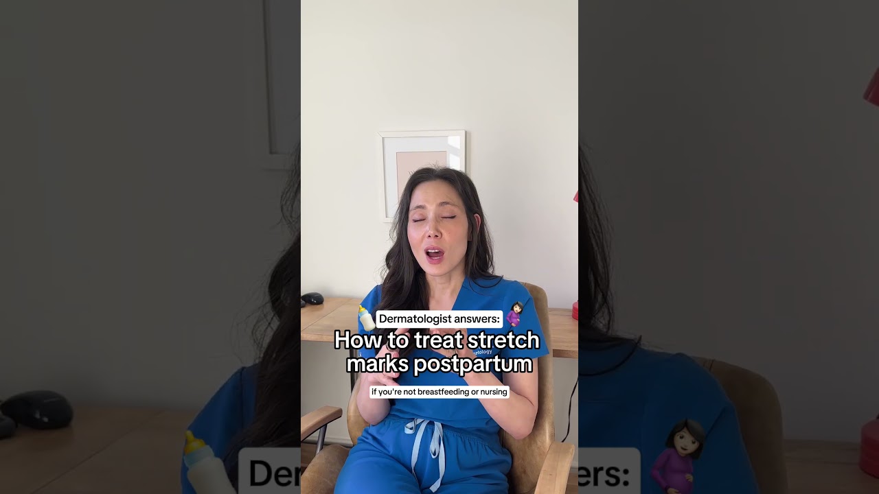 Treat Stretch Marks Postpartum