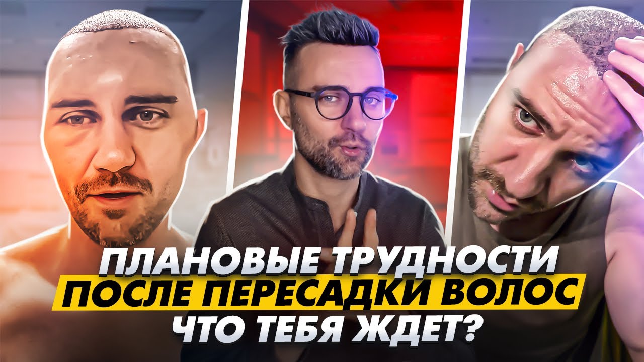 Типичные проблемы после пересадки волос: что тебя ждет? / KRASAV4IK