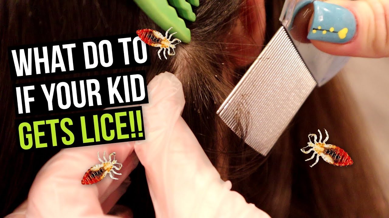 What to do if your Kid Gets Head Lice