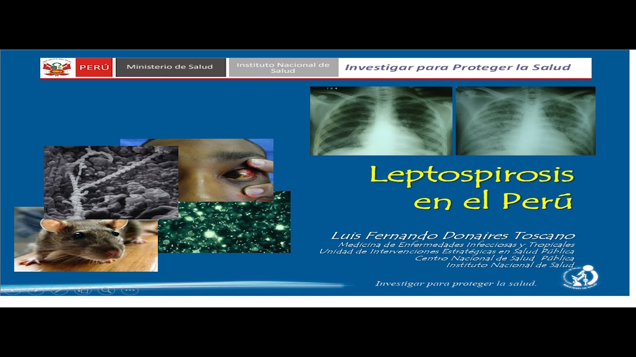 LEPTOSPIROSIS