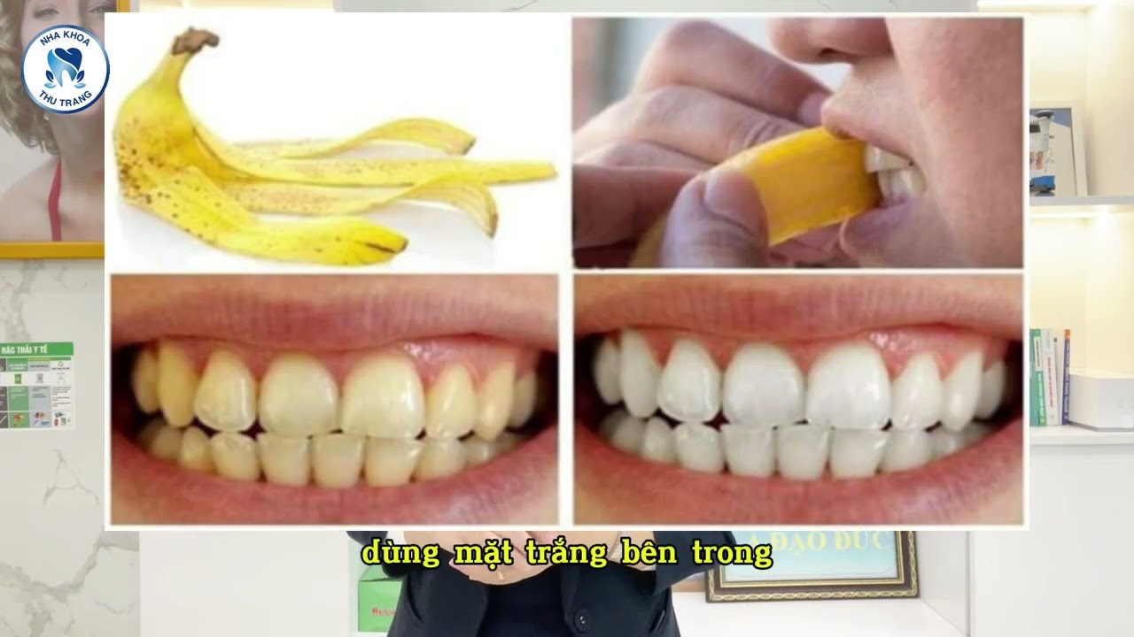 4 Cách làm trắng răng tại nhà đơn giản mà không tốn một đồng 