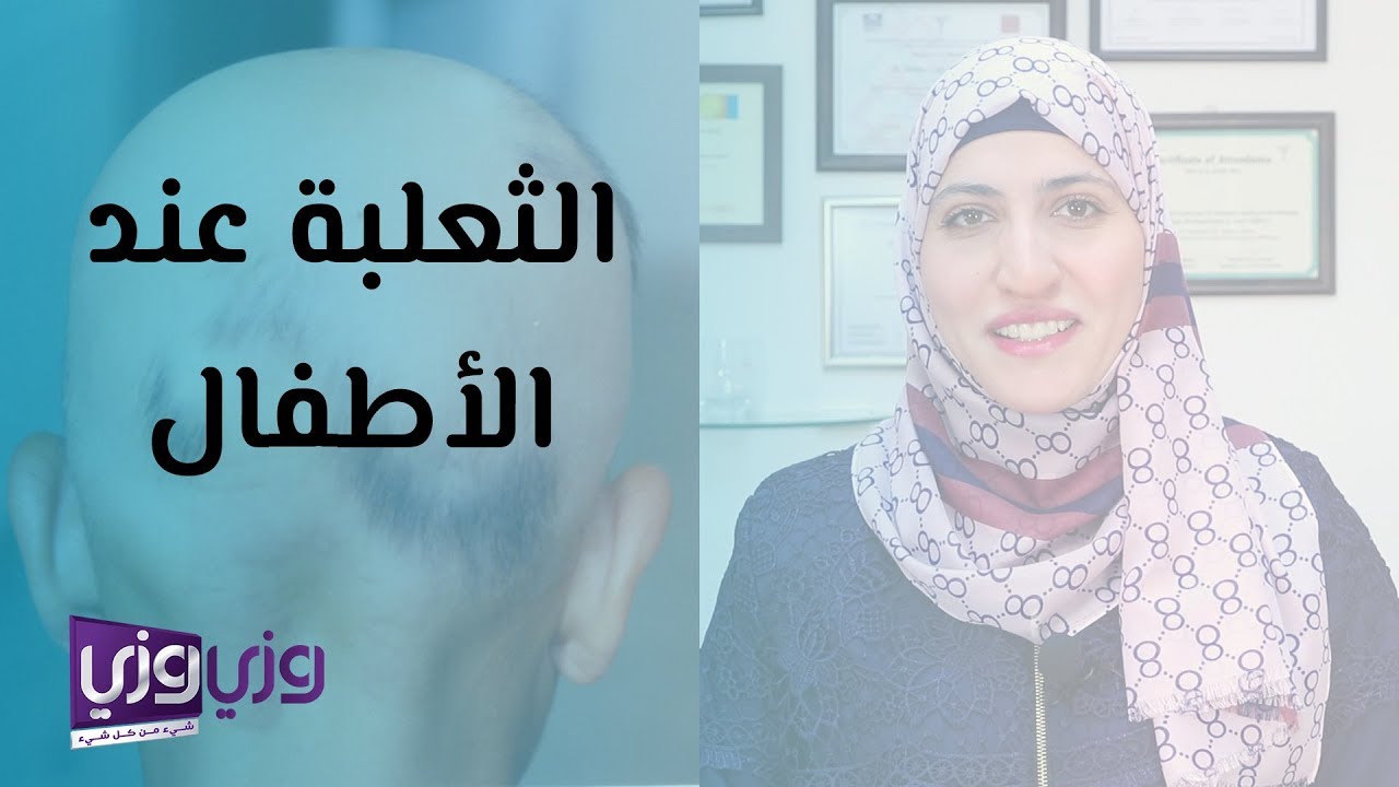 الثعلبة عند الاطفال