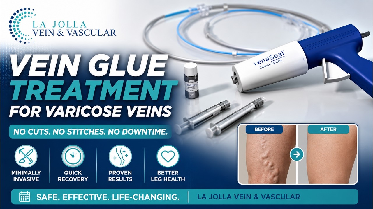 VenaSeal™ Treatment For Venous Reflux