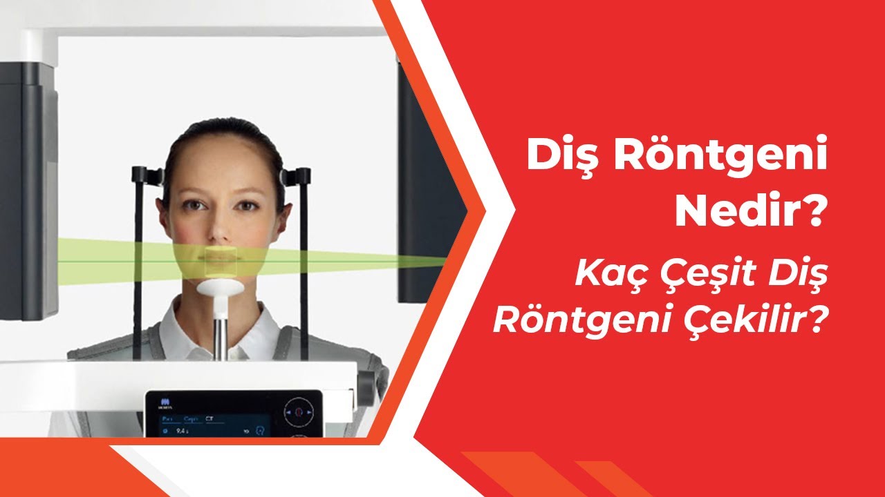 Diş Röntgeni Nedir? Kaç Çeşit Diş Röntgeni Çekilir?