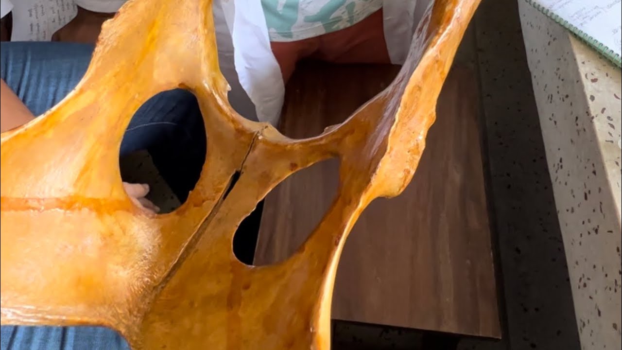Pelvic girdle of ox... [Comparative anatomy]... #anatomy #dvm #veterinary